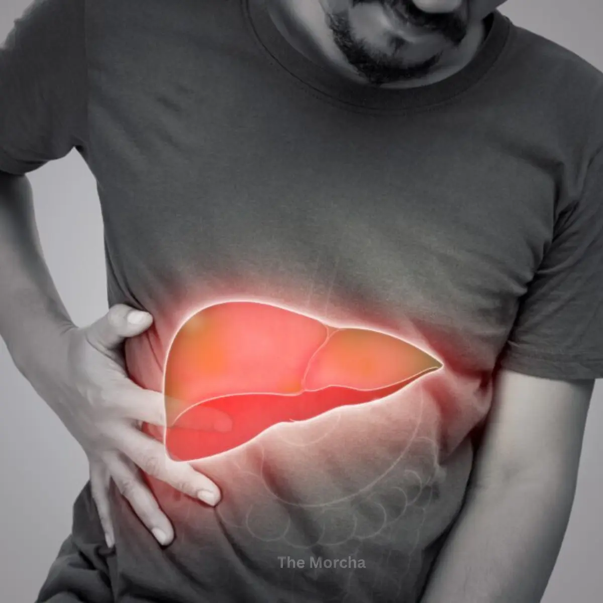 Fatty Liver, Obesity & Diabetes: Powerful Causes and Proven Prevention