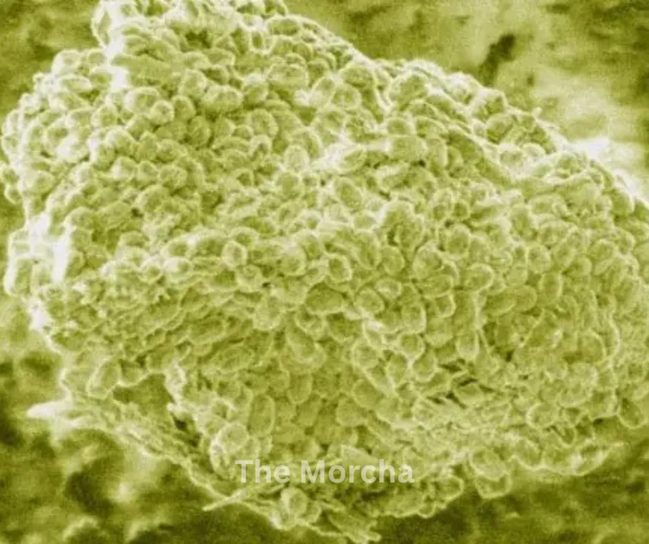 Bacteria vs. Cancer: The Shocking Breakthrough Turning a Deadly Enemy into a Life-Saving Cure (photo 2)