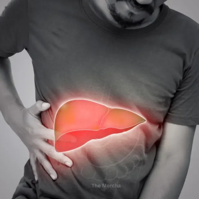 Fatty Liver, Obesity & Diabetes: Powerful Causes and Proven Prevention