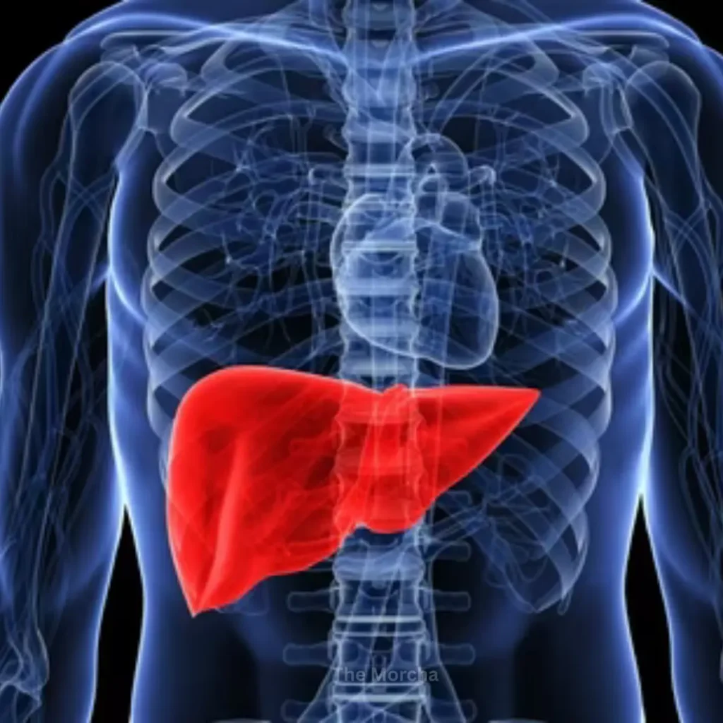 Fatty Liver